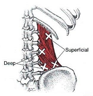 Quadratus Lumborum anatomical drawing