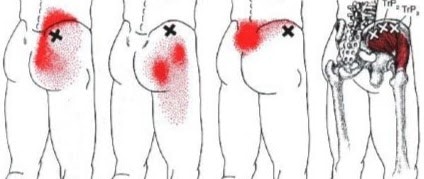 gluteus medius and gluteus minimus anatomical drawing