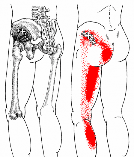 gluteus minimus anatomical drawing