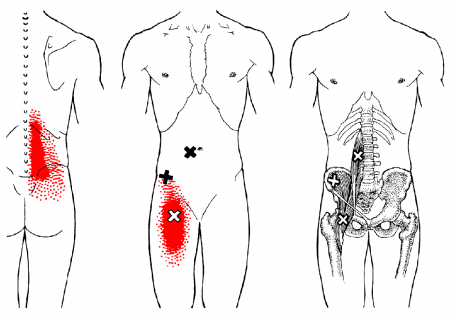 Iliopsoas anatomical drawing