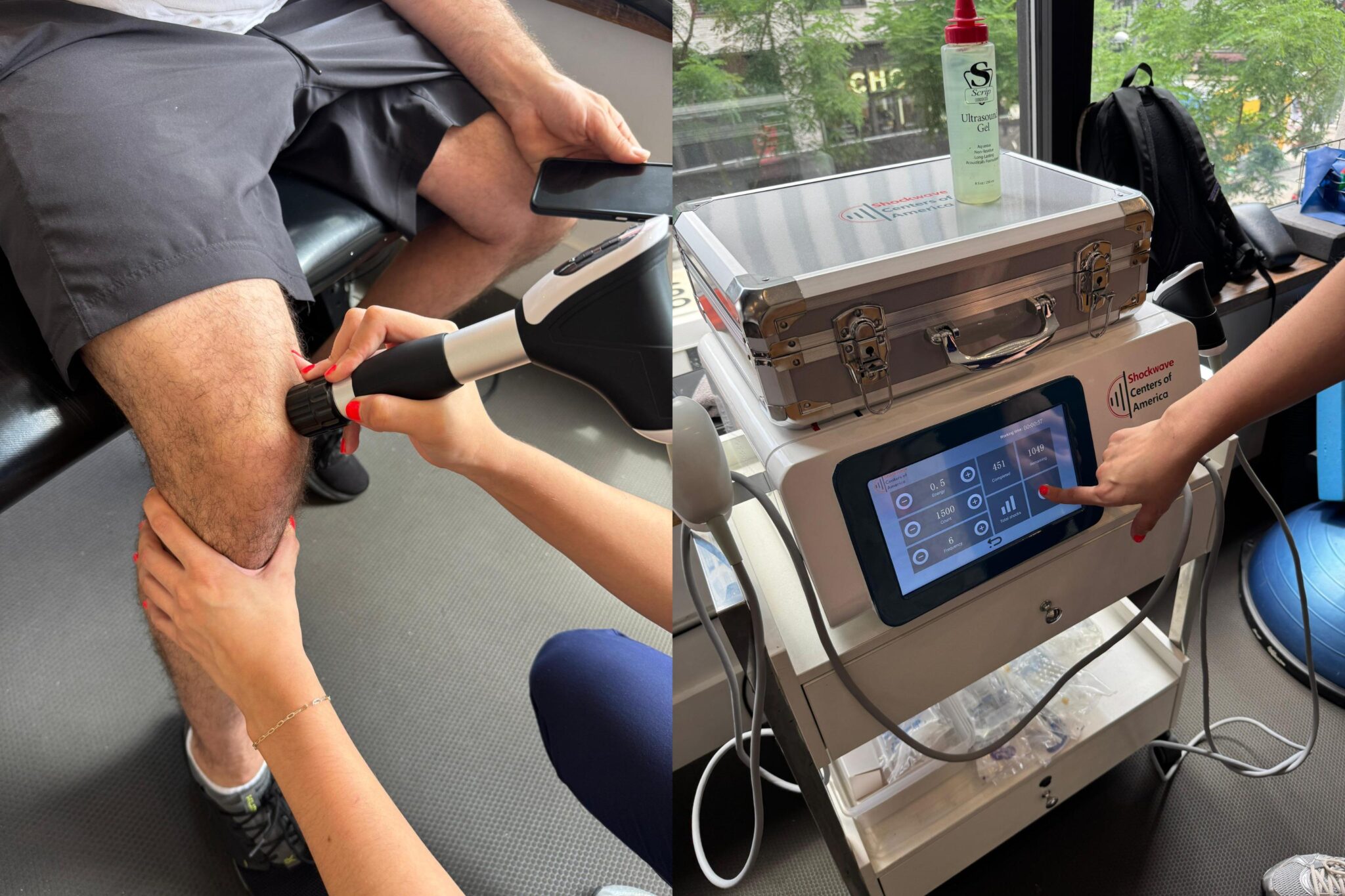 Shockwave Therapy at Physio Logic NYC
