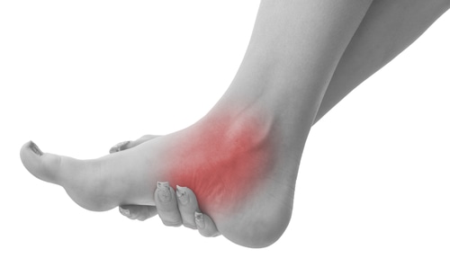 pain in medial arch of foot