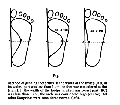 weak arch foot