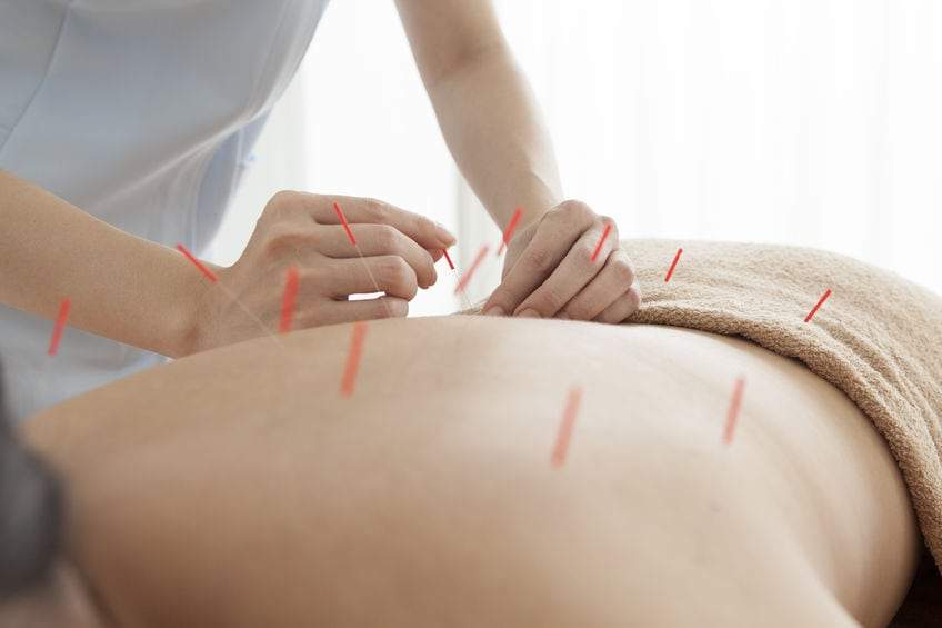 Acupuncture for Weight Loss at Physio Logic in Downtown Brooklyn