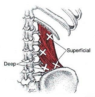 Back pain: Common causes and treatments