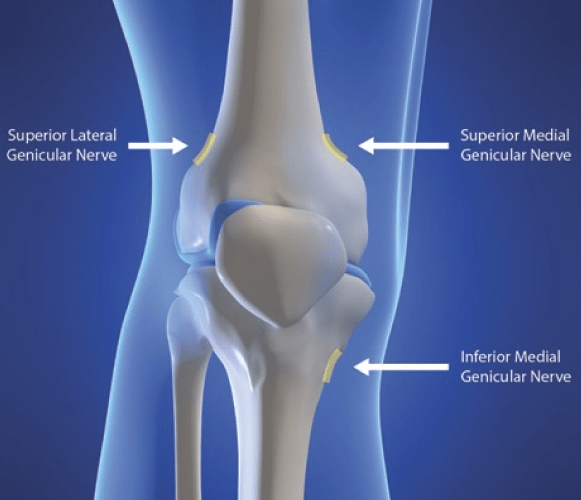 Genicular nerve block for knees in Brooklyn, NY at Physio Logic NYC.
