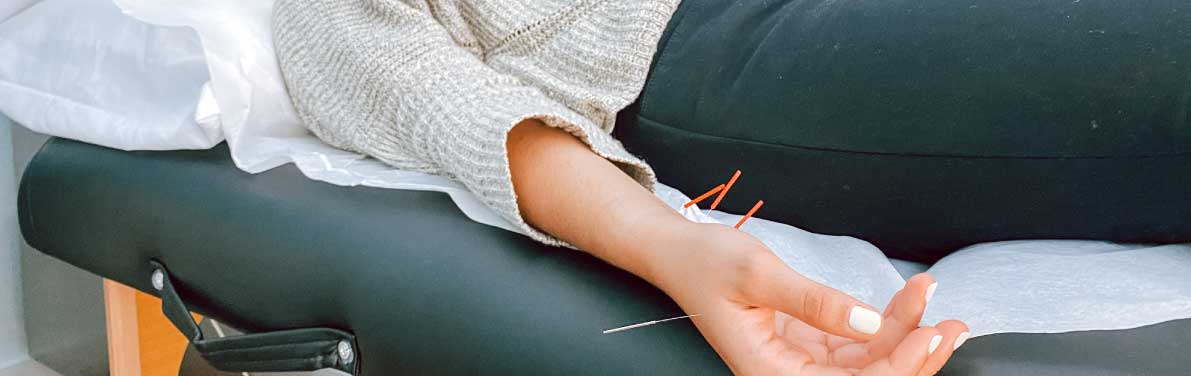 Acupuncture for anxiety being performed at Physio Logic NYC in Downtown Brooklyn, NY.