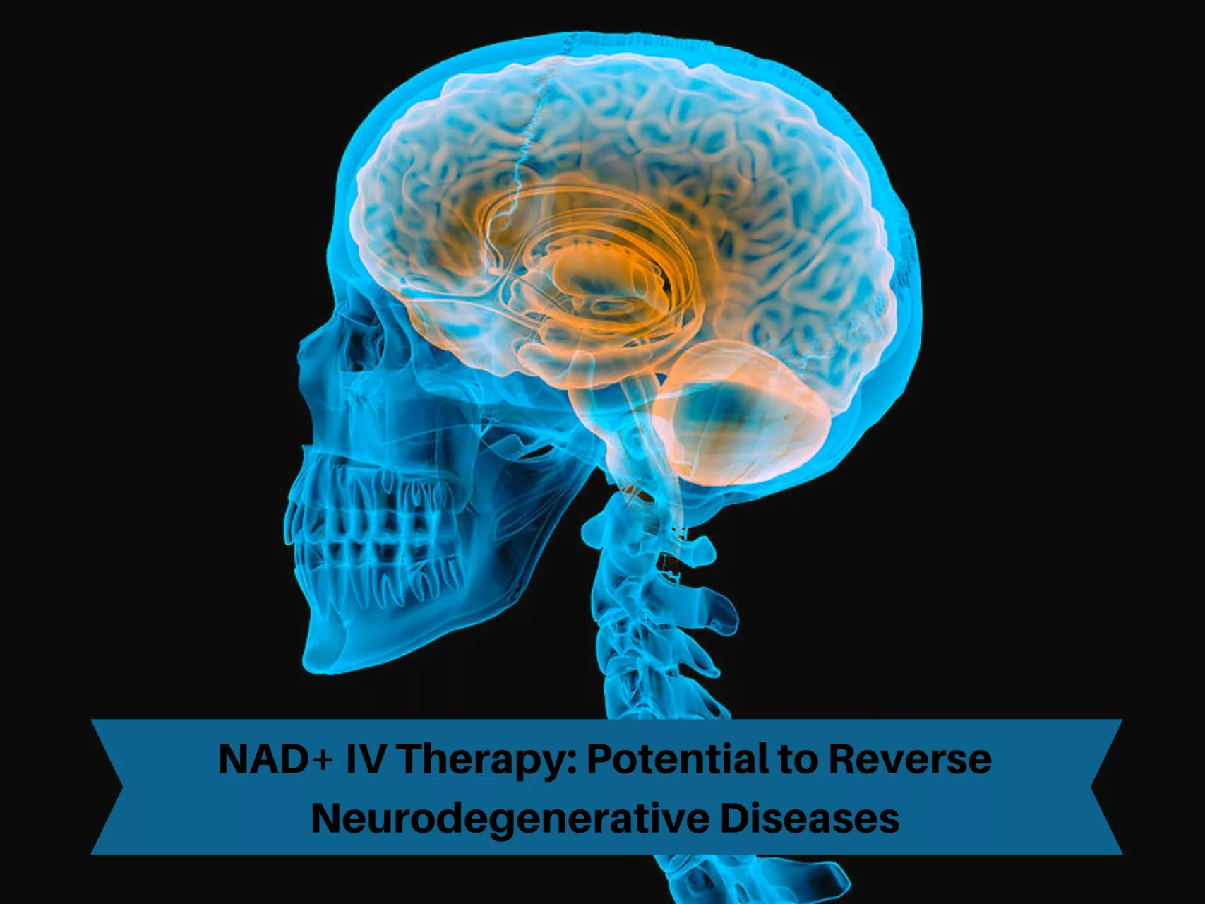 NAD+ IV therapy for diseases